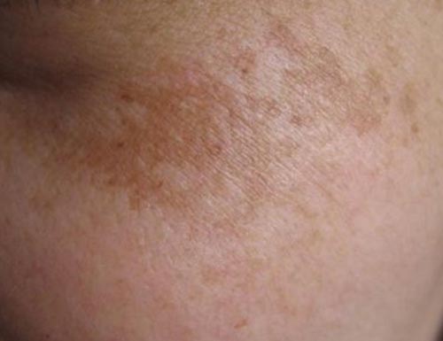 Whitening and Moisturizing Lotion